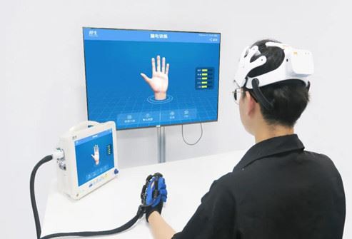 Ampliación del hospital al hogar: la rehabilitación de la mano requiere persi...